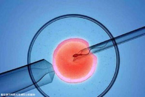 供卵代生公司